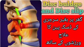 Backpain treatment by dr warda  S6  Exercises for disc pain  UrduHindi [upl. by Gnahc]