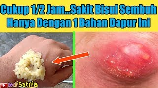 BisulanCukup Tempelkan Bahan Dapur Ini Kurang 1 Jam Langsung Njebrottt [upl. by Zednanreh]