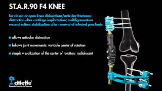 Citieffe  Articulated External Fixator STAR90 F4 KNEE Trauma and Orthopaedic Surgery [upl. by Frankhouse]