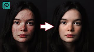 Remove Pigmentation Melasma Freckles Brown Spots  Results In One Week  Ghazal Siddique [upl. by Fu433]