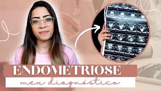 ENDOMETRIOSE MEU DIAGNÓSTICO E SINTOMAS  Monique Nicassio [upl. by Anilocin785]