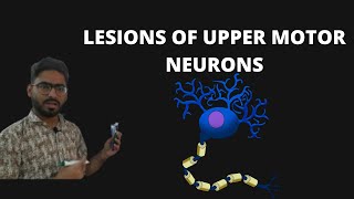 UPPER MOTOR NEURON LESIONS UMN LESIONS [upl. by Sheets]