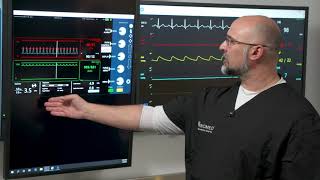 Understanding the SmartAssist AIC [upl. by Aihsel43]