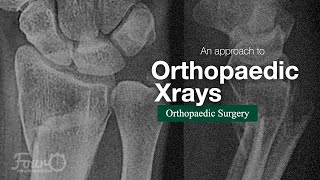 The ABCS approach to orthopaedic xrays [upl. by Katy]