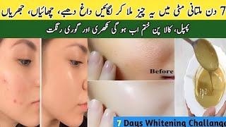 Multani Mitti Face Pack  Multani Mitti Face Pack For Glass Skin  Best Face Pack For Acne Free Face [upl. by Ylicic]