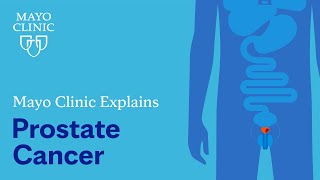 Mayo Clinic Explains Prostate Cancer [upl. by Susejedesoj189]