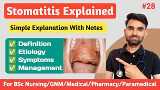 Stomatitis in Hindi  Causes Symptoms And Management of Stomatitis [upl. by Auqeenahs293]