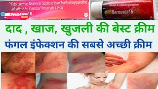 dad ki acchi cream ।। khujli ki cream।। fungal infection ki cream।। dermovent 5 use in hindi [upl. by Kral]