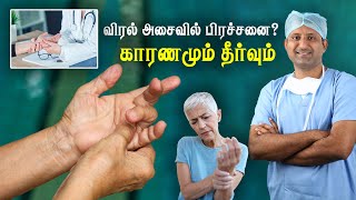 விரல்களில் வலி விரல் இருக்கம் வர காரணமும் தீர்வும்  Trigger Finger  tamil  Dr Jeya Venkatesh [upl. by Esdnyl]