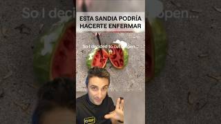 Esta SANDIA podría hacerte ENFERMARcuriosidades supervivencia sabiasque [upl. by Siravaj96]