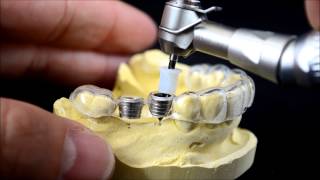 Dental implant surgical guide drilling protocol [upl. by Doss]