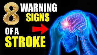 What Are the 8 Warning Signs of a Stroke [upl. by Fasa764]