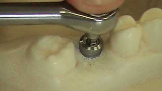 Dental implants course video part 2 [upl. by Nairad]