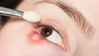 Why You Have To Wash Makeup Brushes  Eye InfectionStye [upl. by Ruyam291]