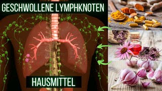 9 Natürliche Hausmittel für geschwollene Lymphknoten [upl. by Erlandson118]