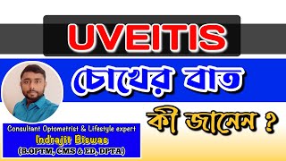 Uveitis কি চোখের বাত কি Treatment of Uveitis  Iritis  CHOROIDITIS  Panuveitis [upl. by Ateuqal]