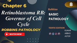 Retinoblastoma RB Governor of Cell Cycle  RB Pathway Neoplasia Lecture 8 Robbins Patho Chapter 6 [upl. by Jed]