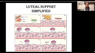 Luteal support simplified IVF Lecture [upl. by Francesca]