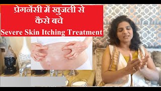 प्रेगनेंसी में खुजली रोकने के उपाय  6 Ways To Stop Severe Itching [upl. by Waring484]