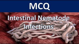 MCQ  Intestinal Nematode Infections with answers [upl. by Eelrahs426]