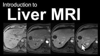 Introduction to Liver MRI Approach and CaseBased Course [upl. by Anirahc]