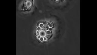 Cryptococcus neoformans Thermotolerance to Avian Body Temperature Is Sufficient For Extracellular [upl. by Asselem]