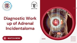 Diagnostic Workup of Adrenal Incidentaloma [upl. by Ahsienel986]