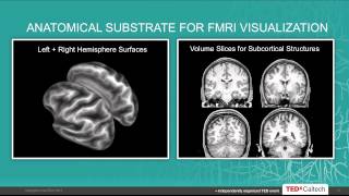 The Human Connectome Project  Relating Brain Circuits to Behavior David Van Essen at TEDxCaltech [upl. by Marella]