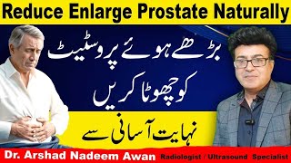 How To Reduce Enlarged Prostate Naturally [upl. by Warila161]