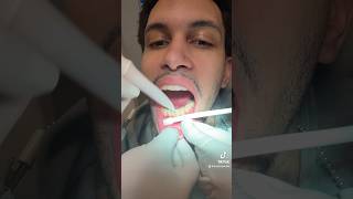 Finger stuck in teeth shortsvideo dentisty [upl. by Annice]