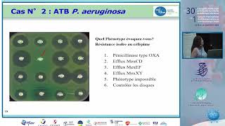 Atelier Lecture et interprétation d’antibiogrammes Basma Mnif [upl. by Amari]