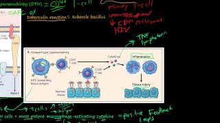 81P DelayedType Hypersensitivity TCellMediated Type IV Hypersensitivity [upl. by Rambow]