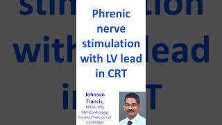 Phrenic nerve stimulation with LV lead in CRT [upl. by Akitnahs]