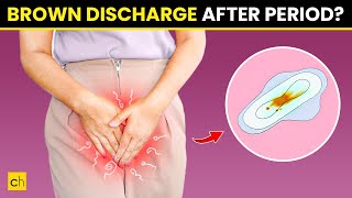 How To Stop Brown Discharge After Period  Causes amp Natural Remedies [upl. by Mak883]