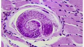 Trichinella spiralis Trichinosis 2  HEALTH EDUCATION  INFECTION CONTROL ICSP  URDU  HINDI [upl. by Pevzner379]