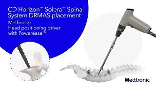 CD Horizon™ Solera™ Spinal System  Dual Rod MultiAxial Screw DRMAS amp Variable Angle Domino VAD [upl. by Nirre]