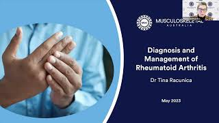 Diagnosis and management of Rheumatoid Arthritis [upl. by Karee]