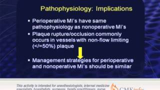 Perioperative Management [upl. by Mathew]