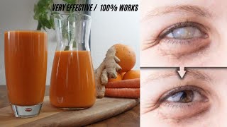 THESE 4 INGREDIENTS WILL REVERSE CATARACT GLAUCOMA FAST  DRINK FOR STRONGER EYES amp BETTER VISION [upl. by Ayikat]