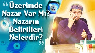 Üzerimde Nazar Var Mı Belirtileri Nelerdir  Mücahid Han [upl. by Gottfried232]