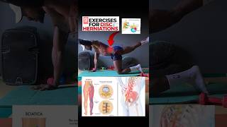 9 Effective herniated disc exercises and stretches herniateddisc herniarepair stretches [upl. by Ellinej]