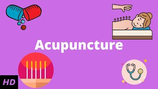 Acupuncture What You Need to Know [upl. by Trebleda]