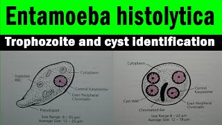 Entamoeba histolytica trophozoite and cyst  microscopic view with identification features [upl. by Mauceri]