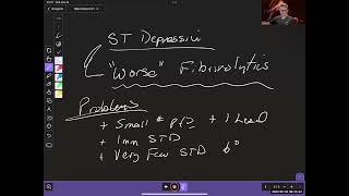 The historical context of STEMI and OMI [upl. by Arabela]