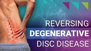 Reversing Degenerative Disc Disease [upl. by Juana41]