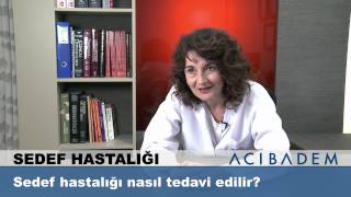 Sedef hastalığı nasıl tedavi edilir [upl. by Arratahs]