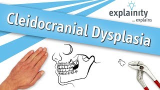 Cleidocranial Dysplasia explained explainity® explainer video [upl. by Fabrianna387]