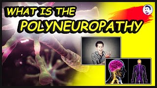 What is Polyneuropathy  Causes  What are the Treatments  Complications  English  2022 [upl. by Robinia847]