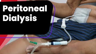 Principle of Peritoneal Dialysis  How peritoneal dialysis works part1 [upl. by Ydor]