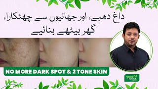 No more Dark Spots amp Two Tone Skin  Pigmentation treatment at home  Dark Spots on Face Removal [upl. by Tuorah]